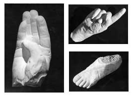photograph of plaster casts made from wax moulds of 'phantom limbs' obtained during siittings