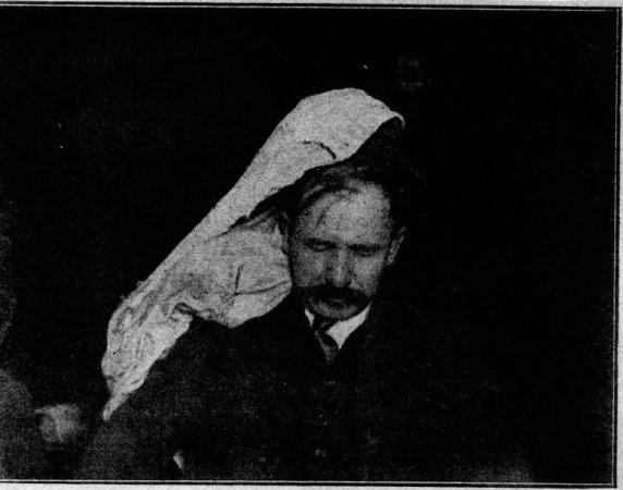Photograph of Franek Kluski during a seance showing the forms of clothing and hair