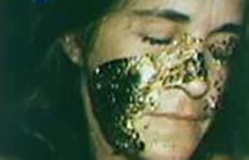 photo of Katie's face with gold leaf