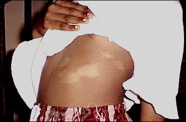 PurnimaBirthmark - 2 - klein Rahmen